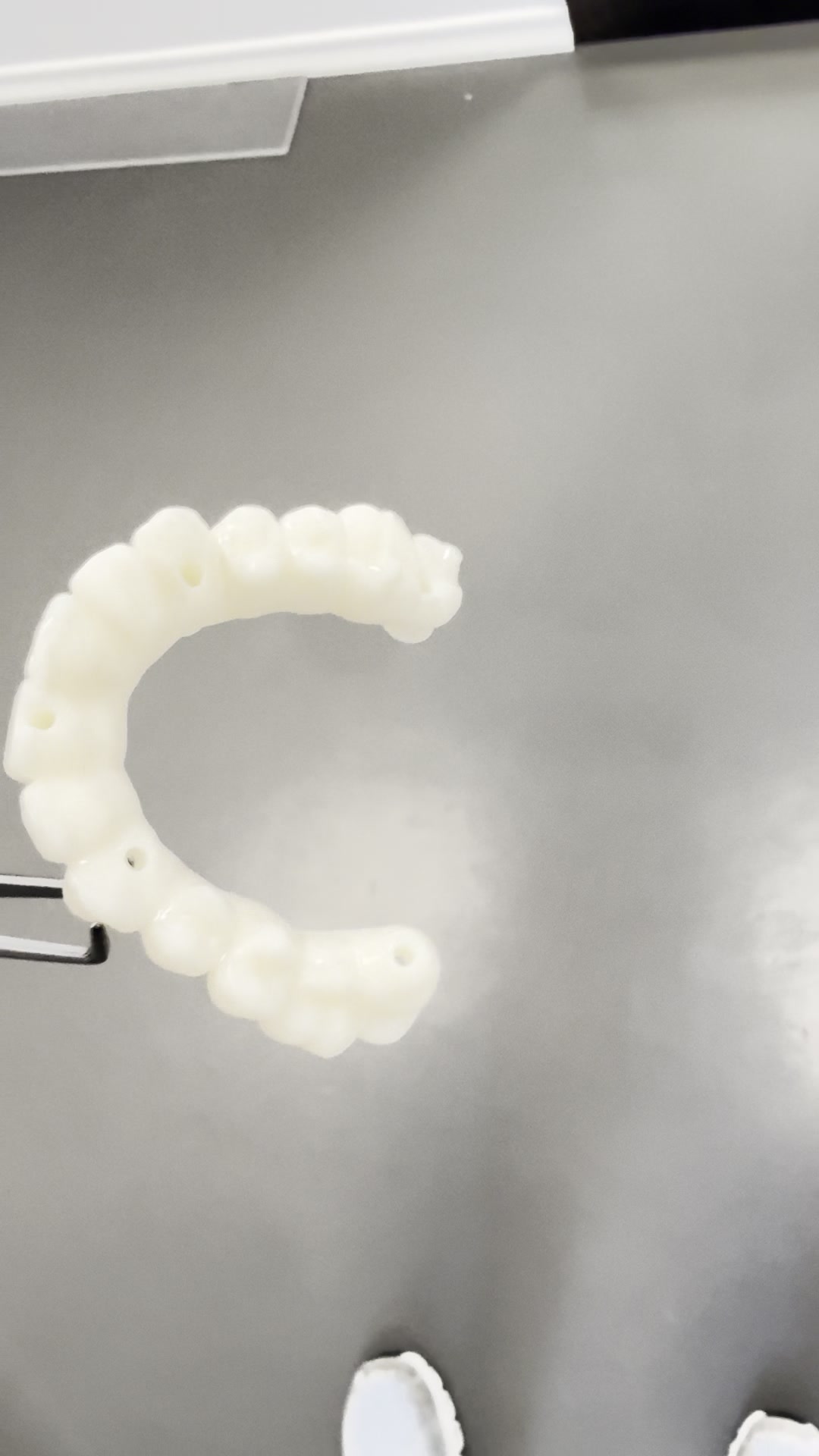 Frisch gedrucktes Langzeitprovisorium aus dem 3D-Labor der Praxis Dr. Vogtner