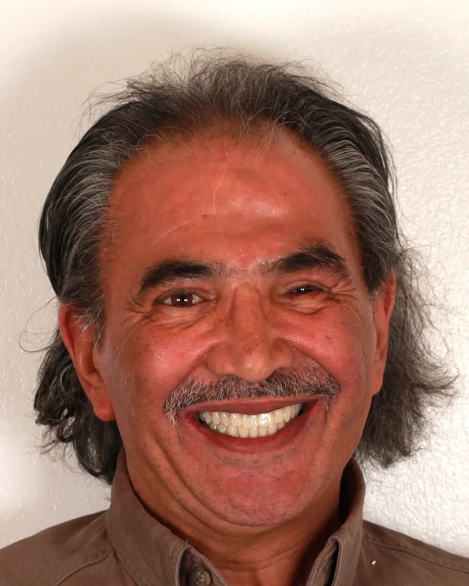 Cemil Portrait nach der Behandlung
